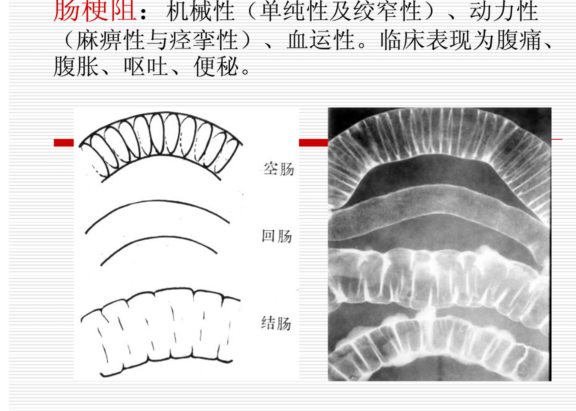 常见疾病的X线与CT诊断学