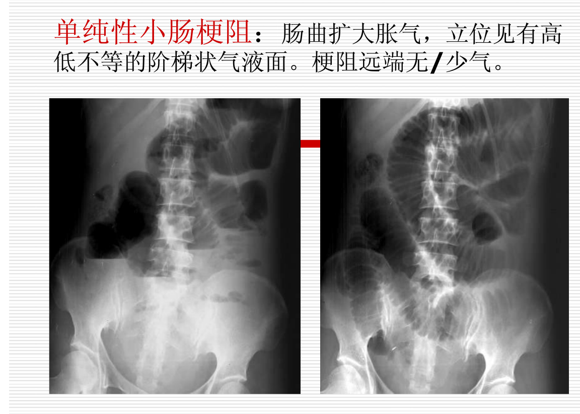 常见疾病的X线与CT诊断学