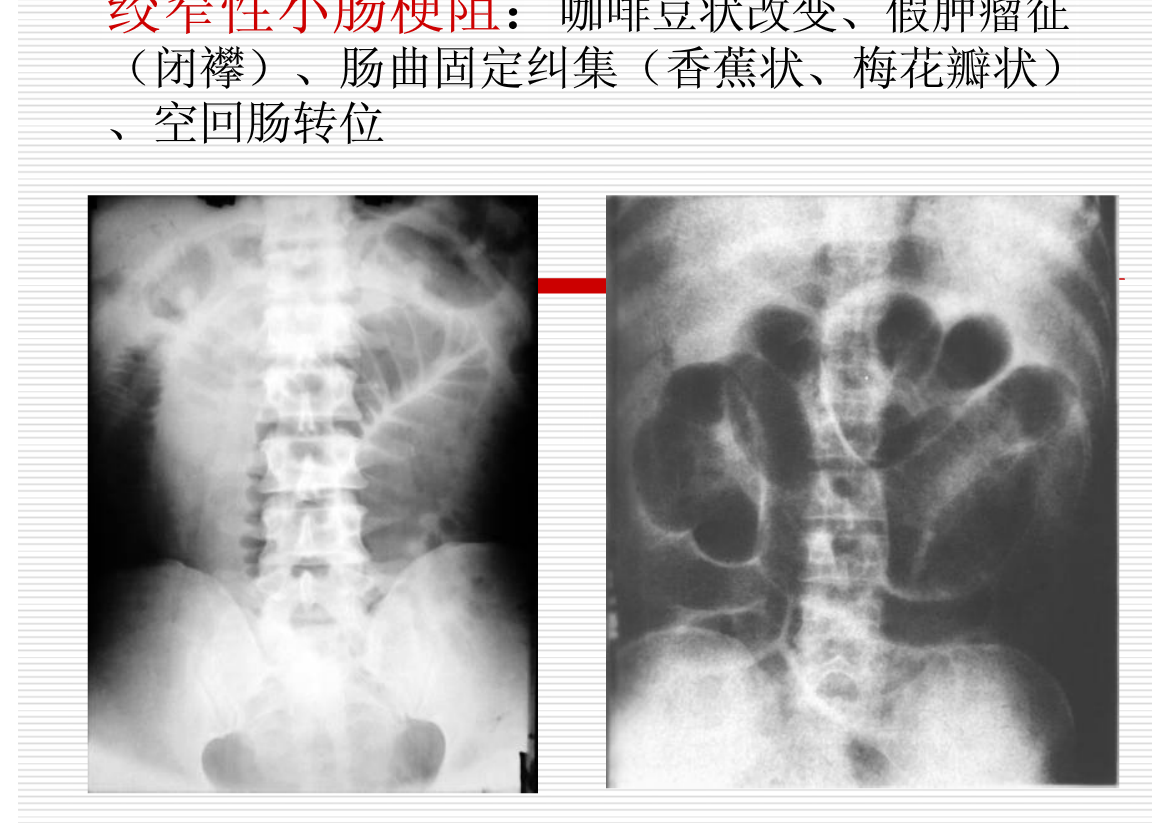 常见疾病的X线与CT诊断学