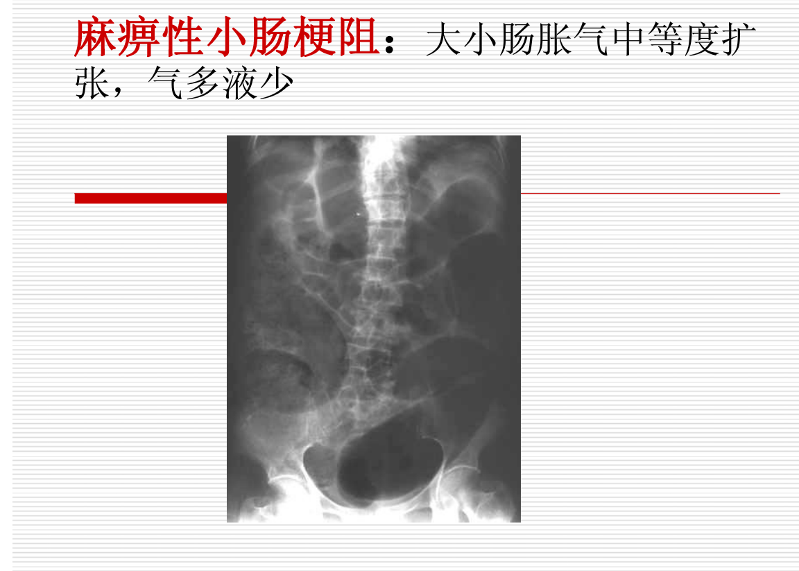 常见疾病的X线与CT诊断学