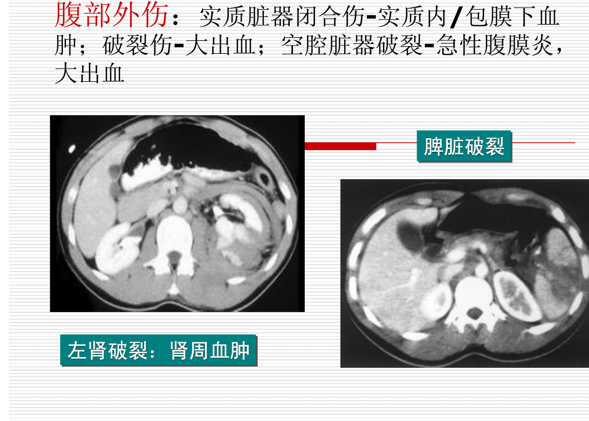 常见疾病的X线与CT诊断学