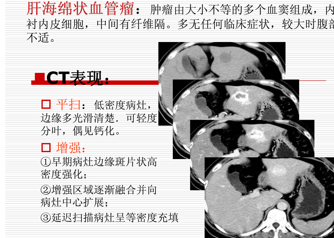 常见疾病的X线与CT诊断学