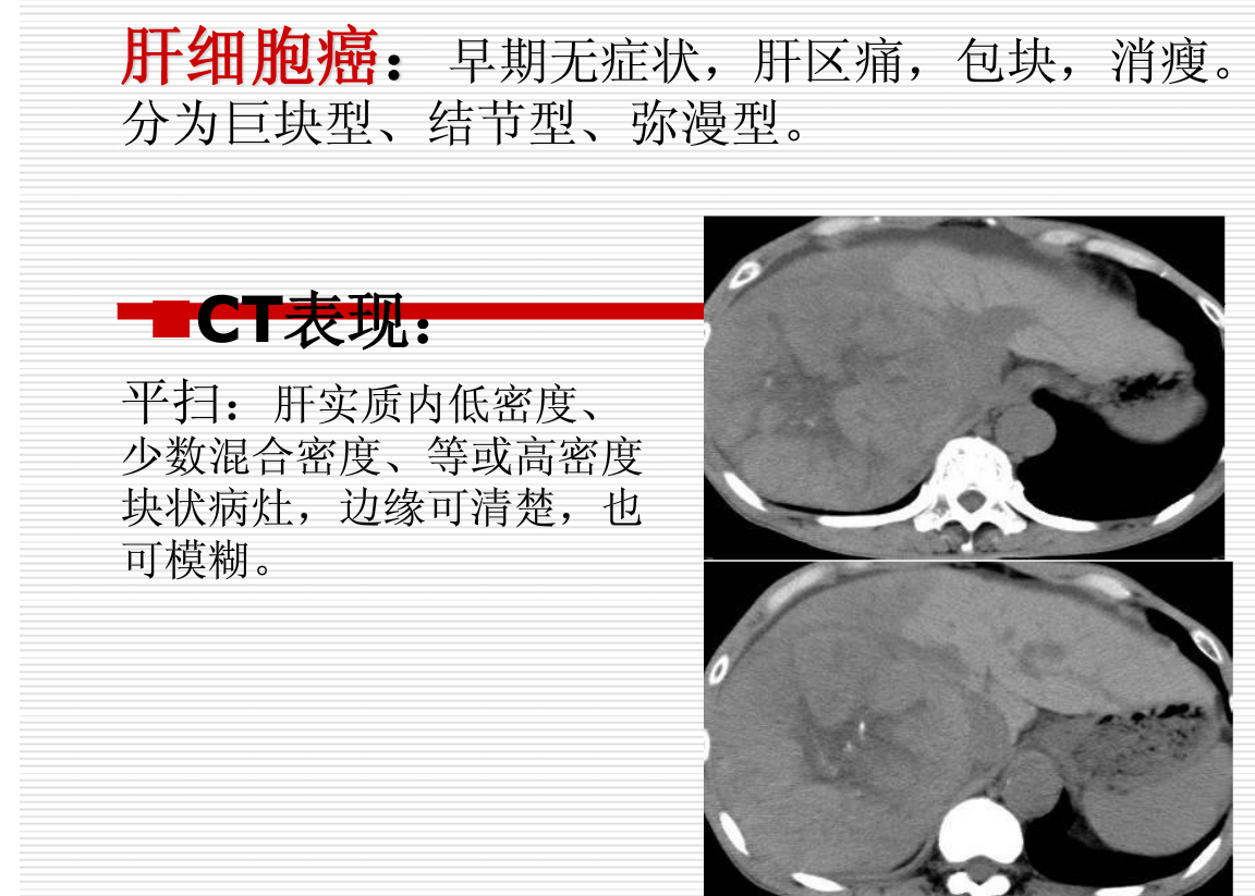 常见疾病的X线与CT诊断学