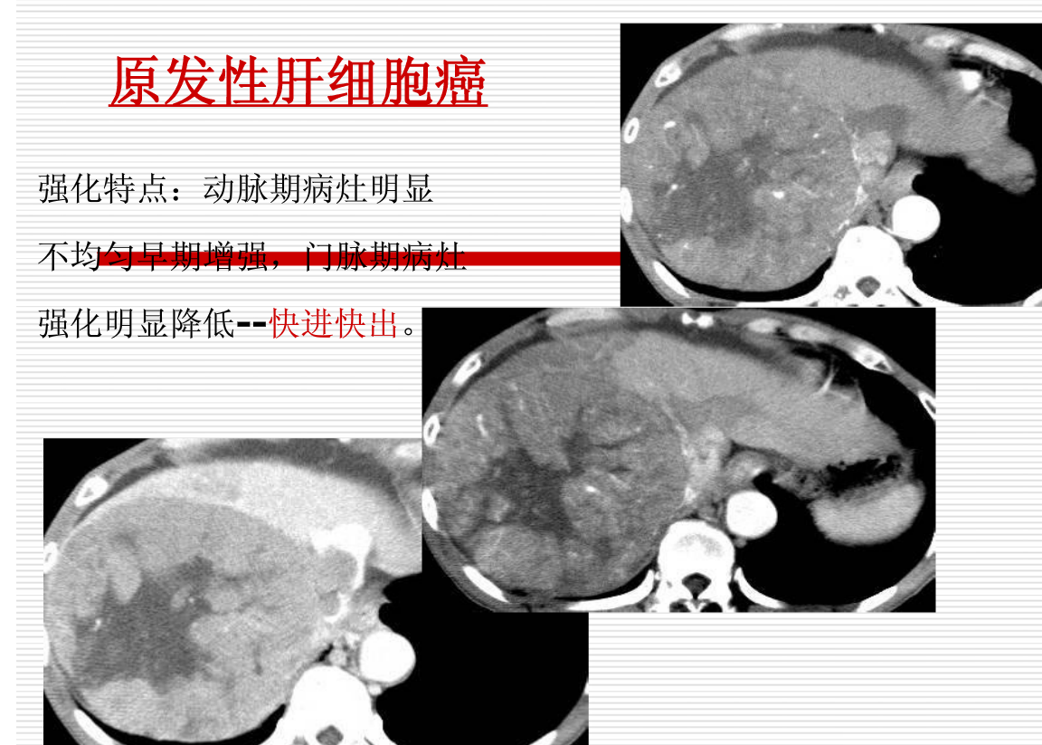 常见疾病的X线与CT诊断学