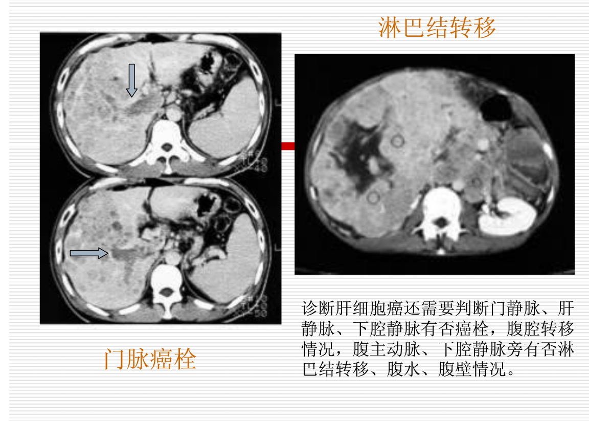 常见疾病的X线与CT诊断学