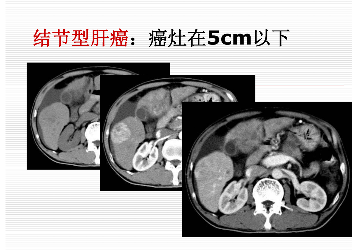 常见疾病的X线与CT诊断学