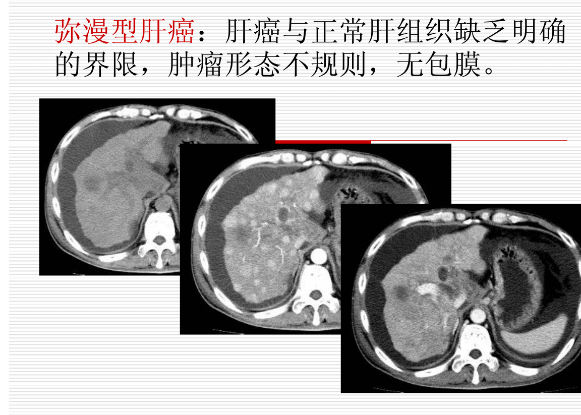 常见疾病的X线与CT诊断学