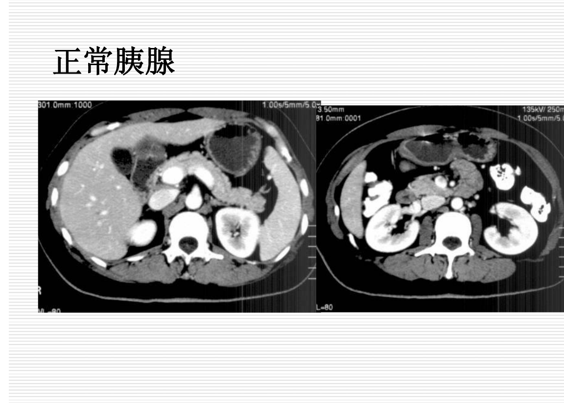 常见疾病的X线与CT诊断学