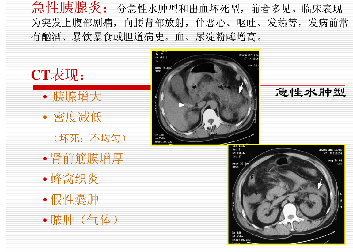常见疾病的X线与CT诊断学