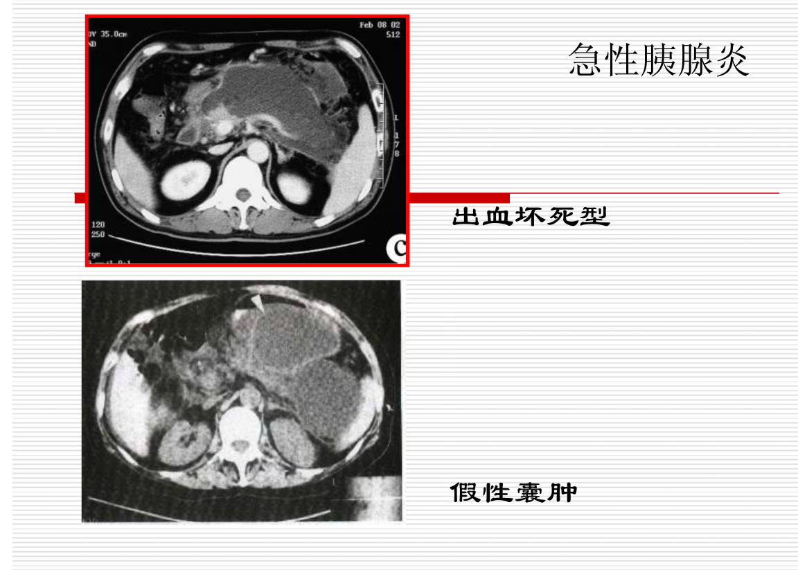 常见疾病的X线与CT诊断学