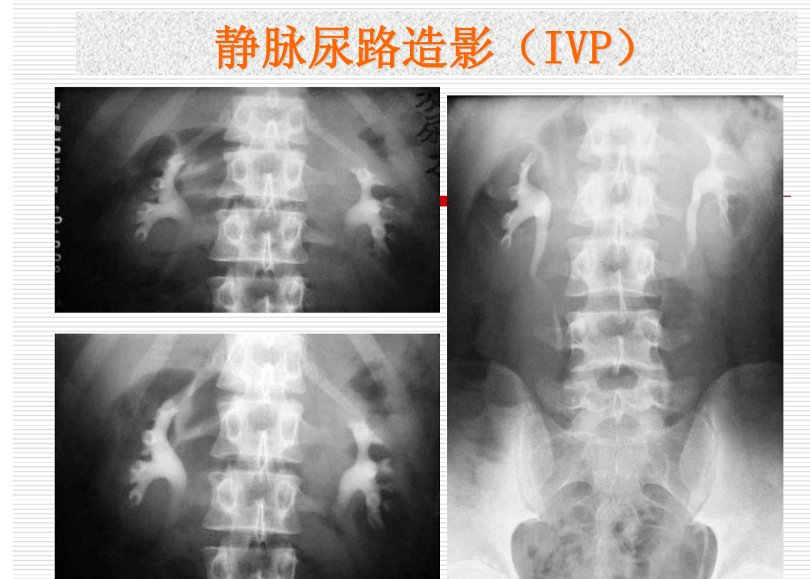 常见疾病的X线与CT诊断学