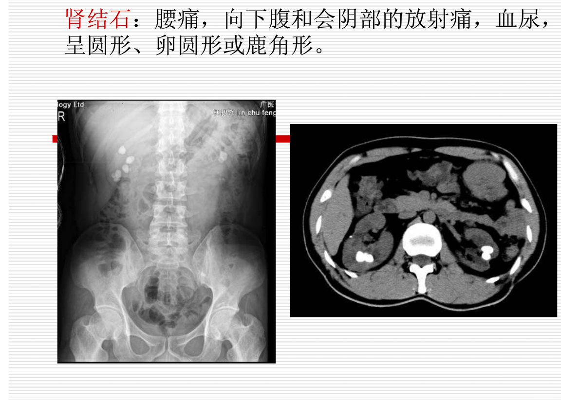 常见疾病的X线与CT诊断学