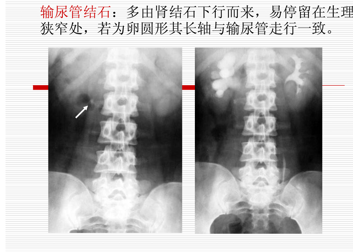常见疾病的X线与CT诊断学