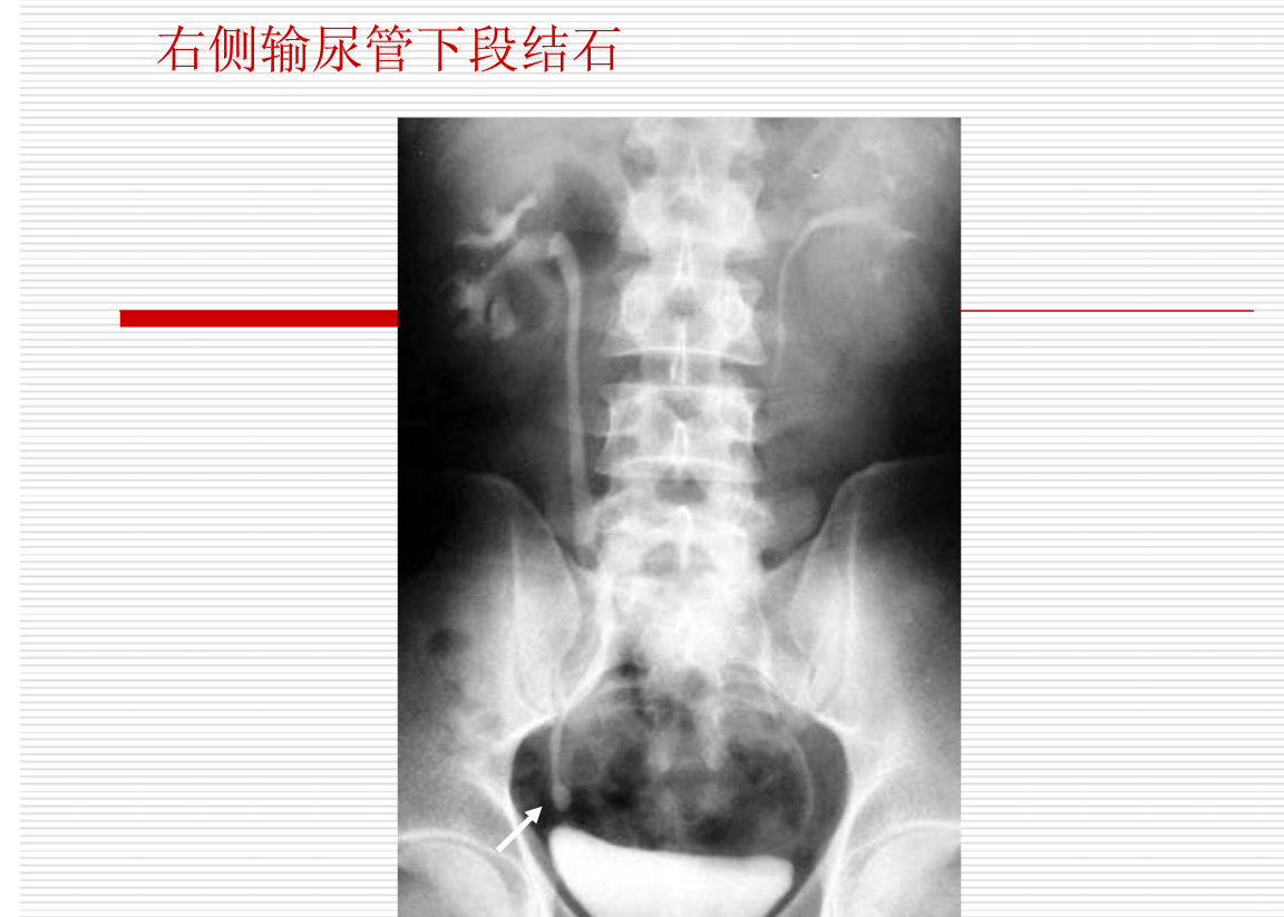 常见疾病的X线与CT诊断学