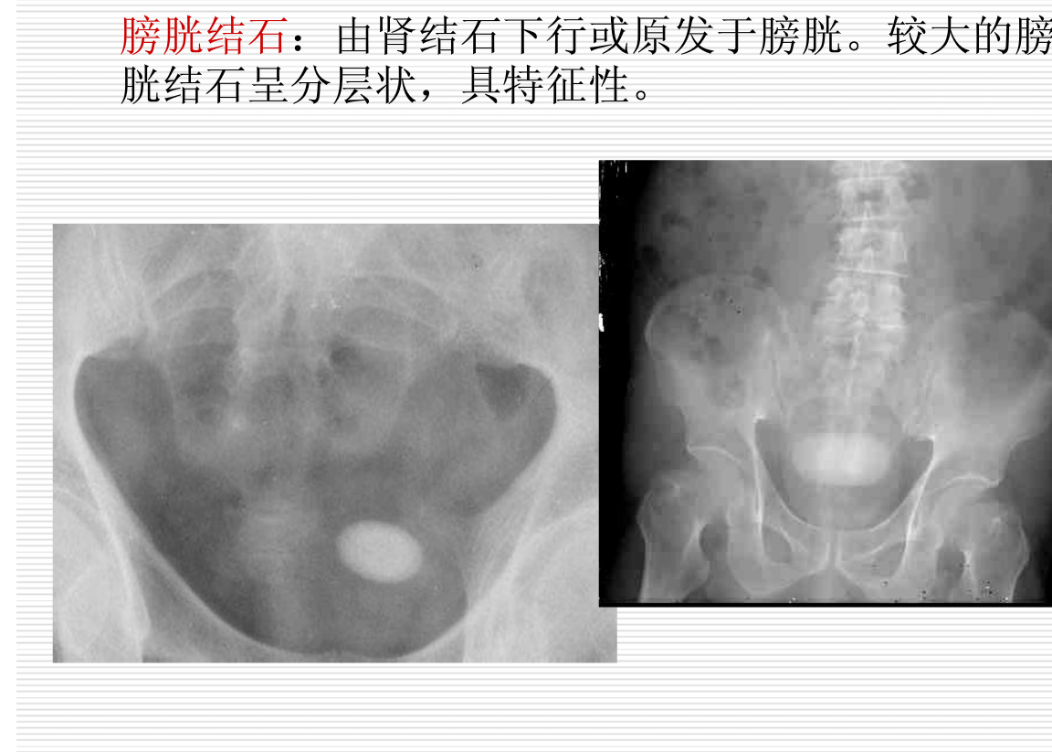常见疾病的X线与CT诊断学