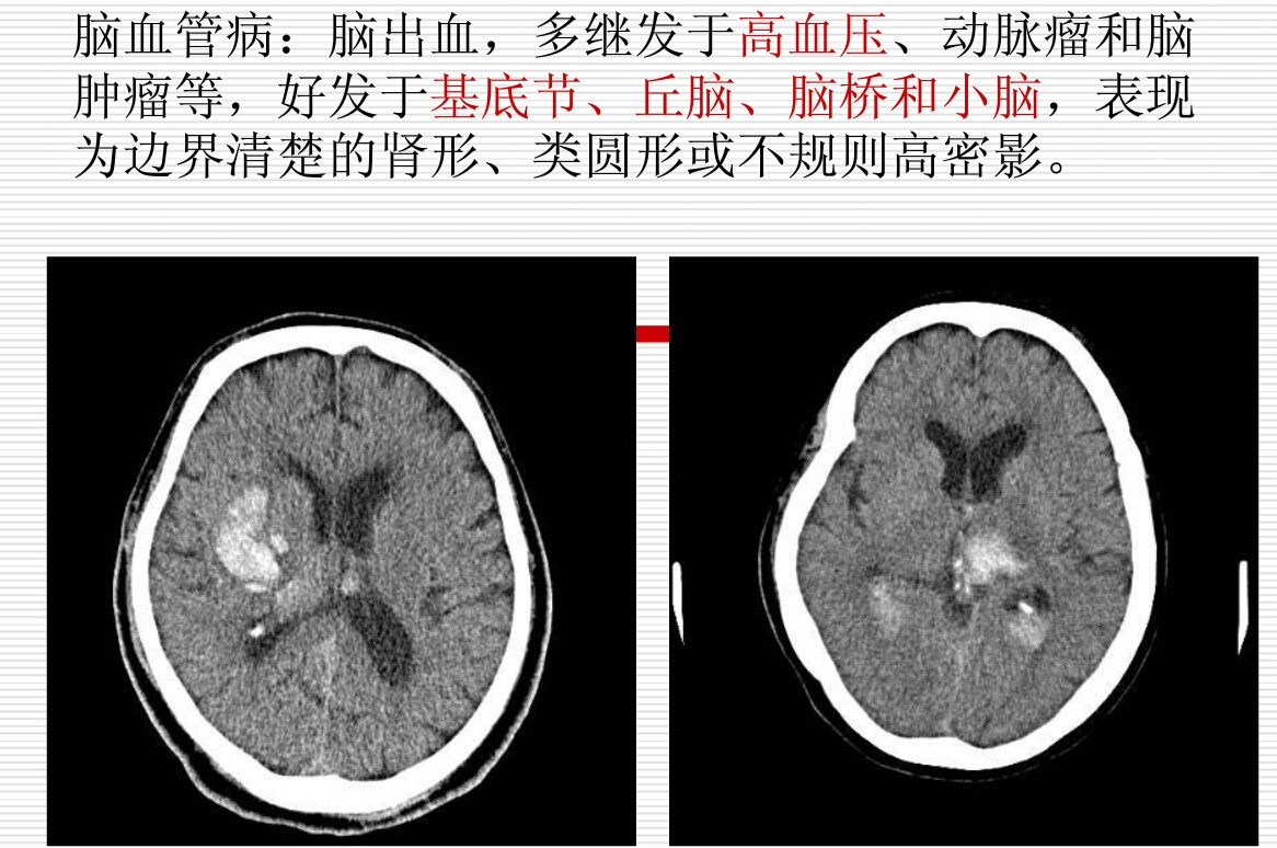 常见疾病的X线与CT诊断学