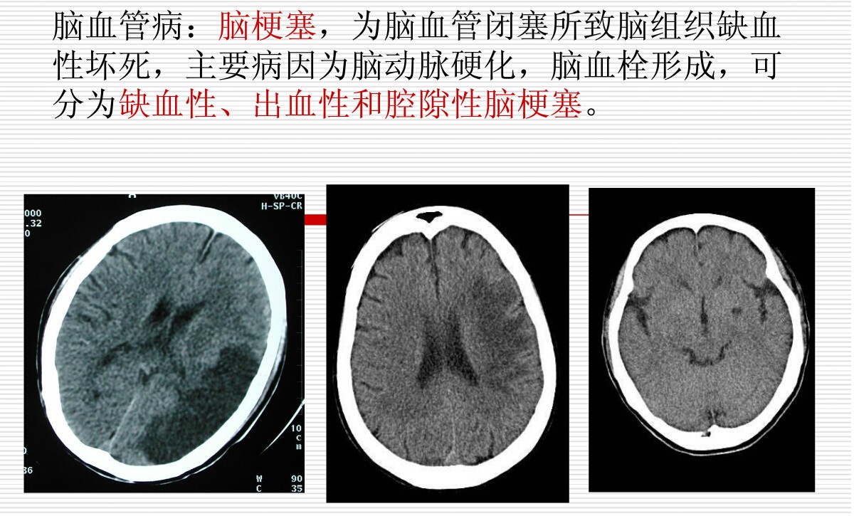 常见疾病的X线与CT诊断学