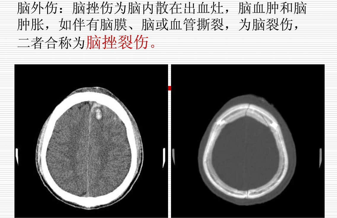 常见疾病的X线与CT诊断学