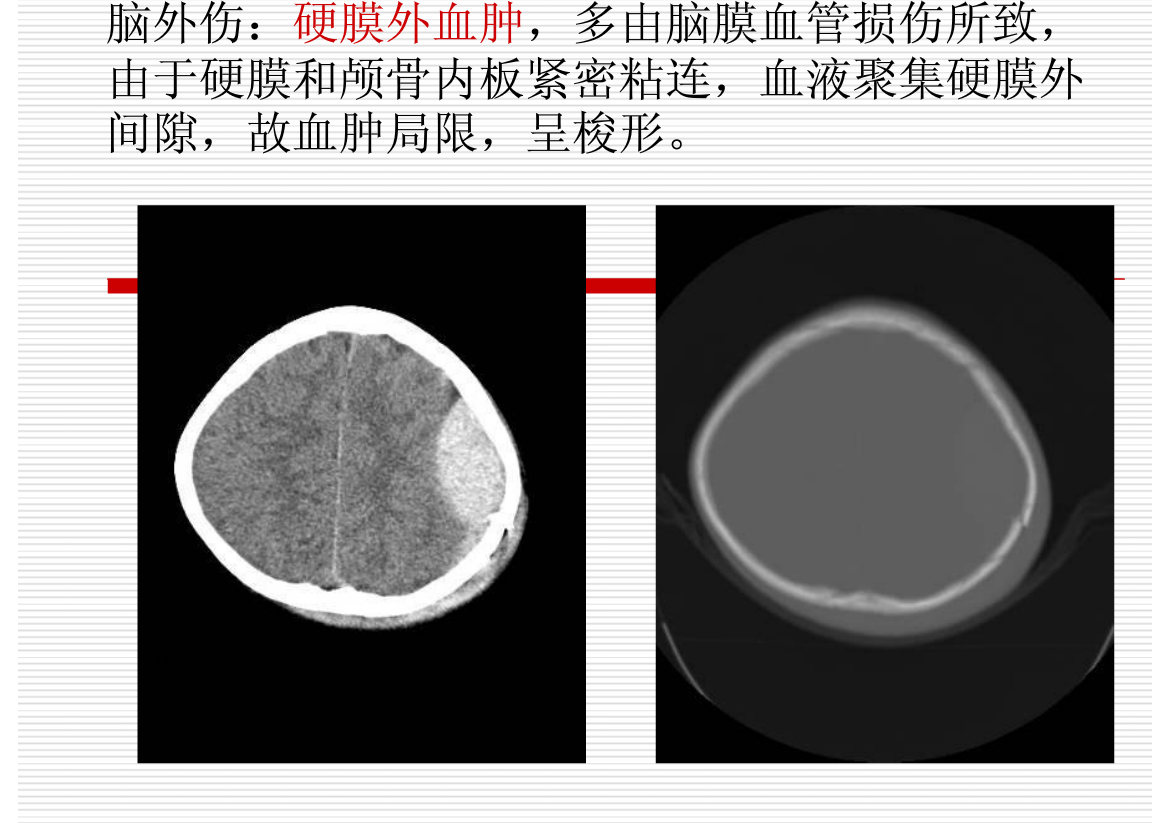 常见疾病的X线与CT诊断学