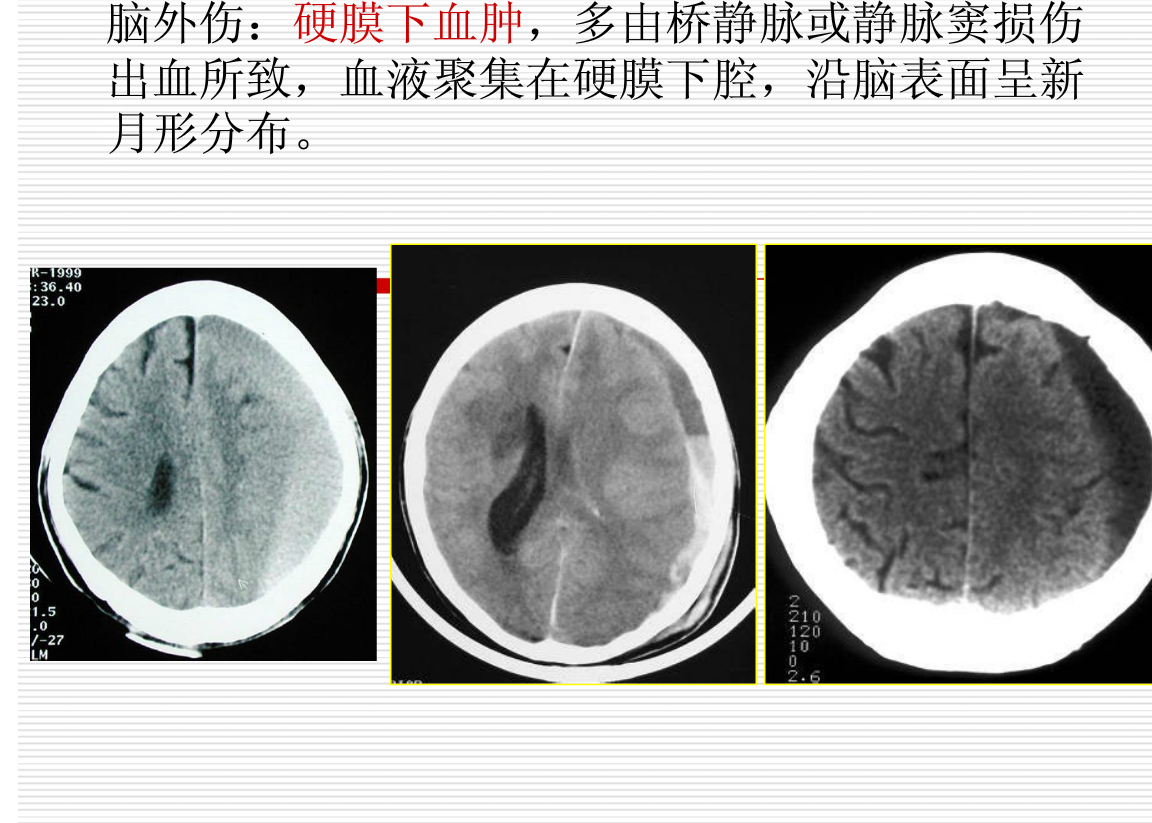 常见疾病的X线与CT诊断学