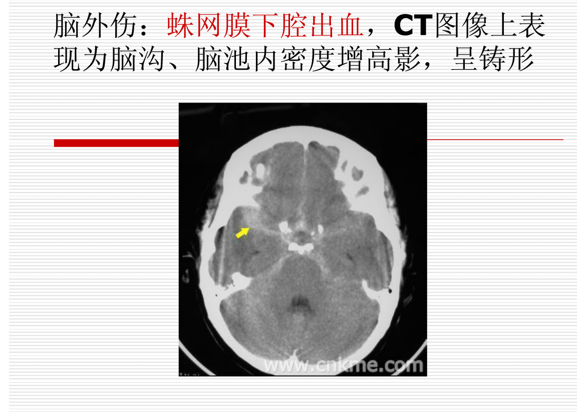 常见疾病的X线与CT诊断学