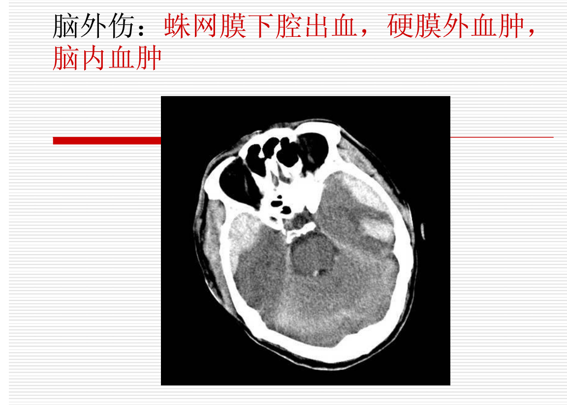 常见疾病的X线与CT诊断学