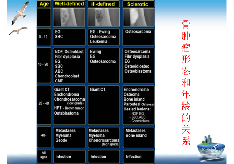 骨肿瘤影像学鉴别诊断
