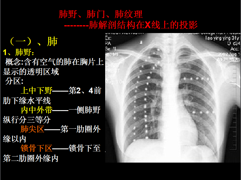 呼吸系统疾病X线诊断