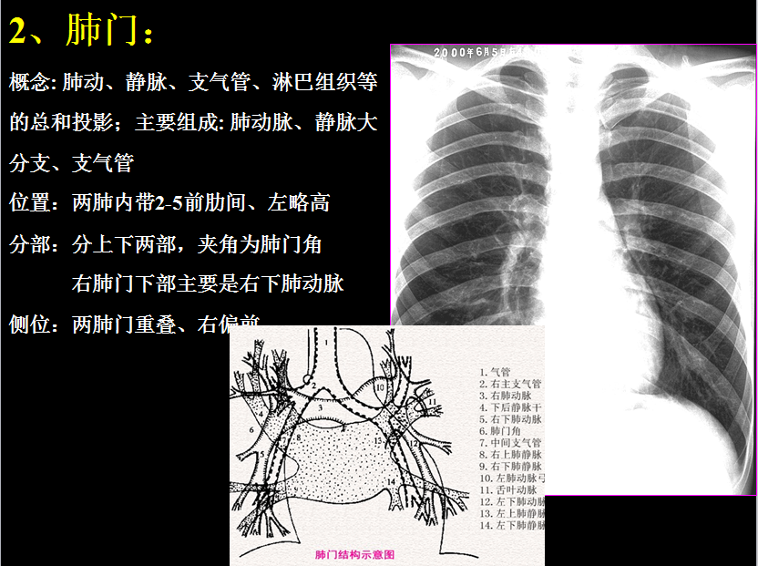 呼吸系统疾病X线诊断