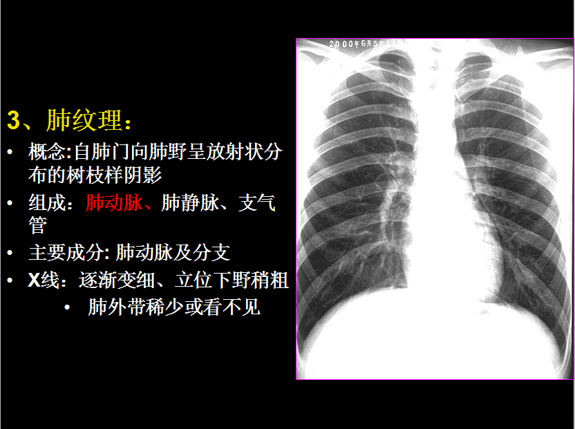 呼吸系统疾病X线诊断