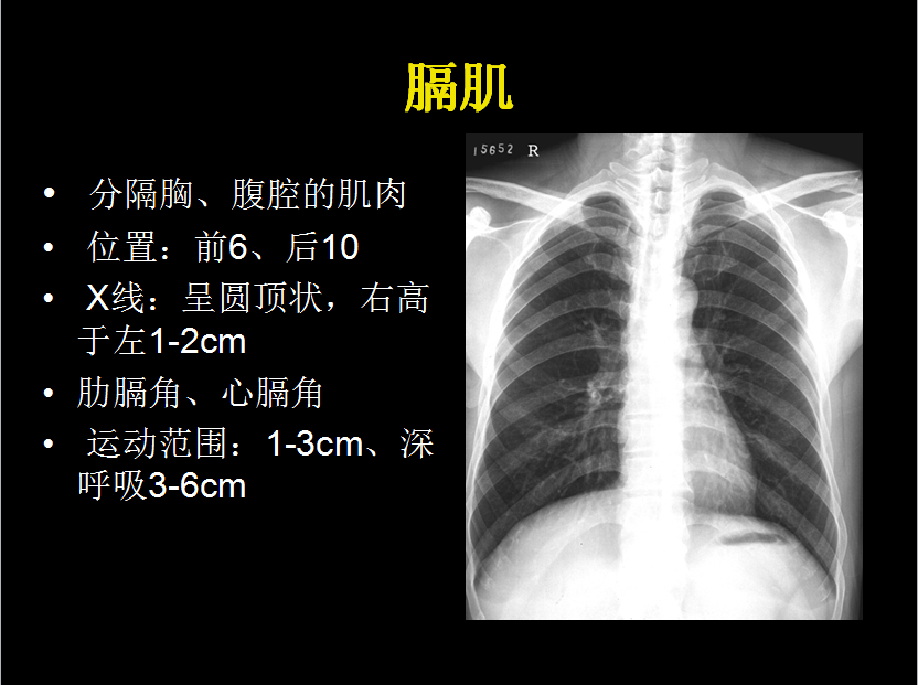 呼吸系统疾病X线诊断