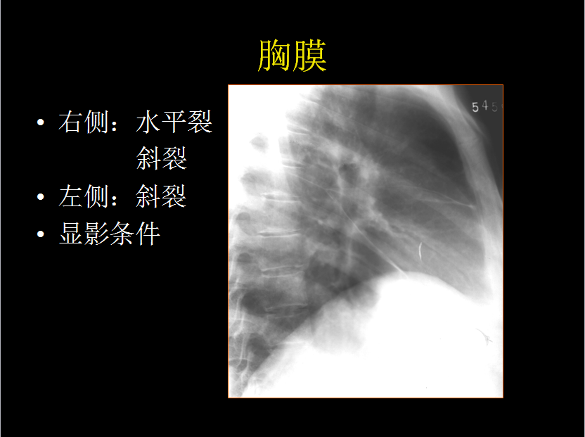 呼吸系统疾病X线诊断