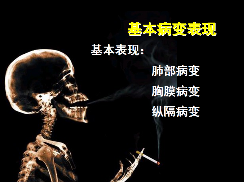 呼吸系统疾病X线诊断