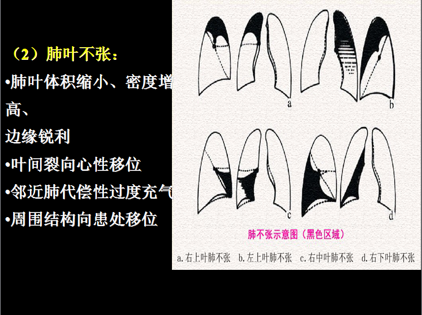 呼吸系统疾病X线诊断