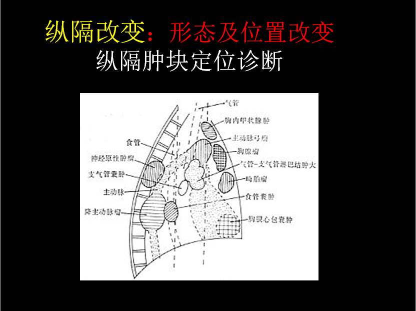呼吸系统疾病X线诊断