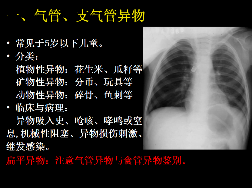 呼吸系统疾病X线诊断