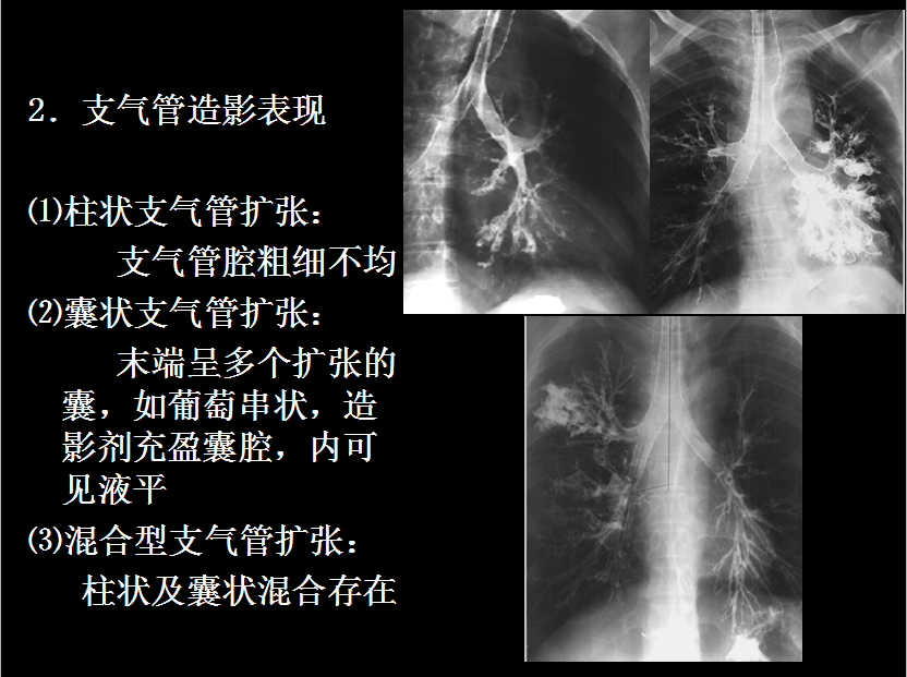 呼吸系统疾病X线诊断