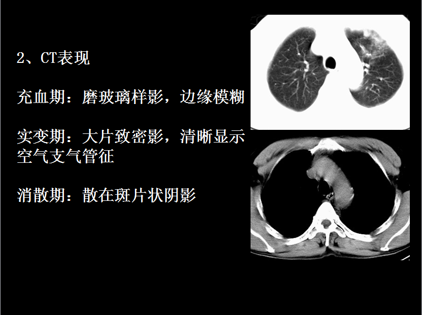 呼吸系统疾病X线诊断