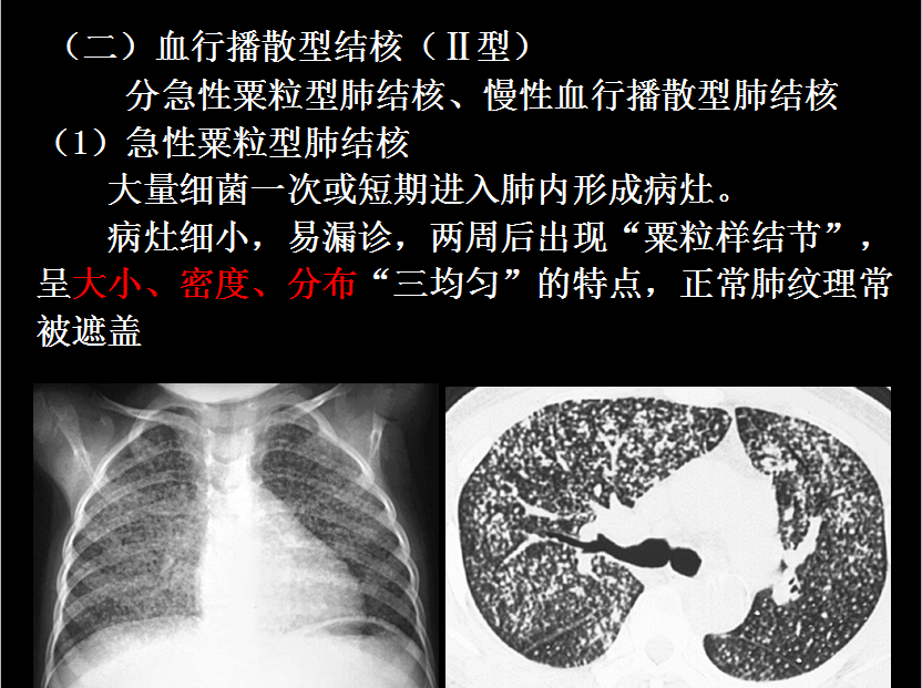 呼吸系统疾病X线诊断