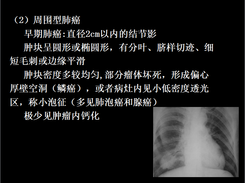 呼吸系统疾病X线诊断