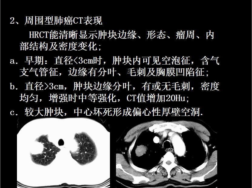 呼吸系统疾病X线诊断