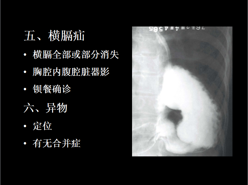 呼吸系统疾病X线诊断