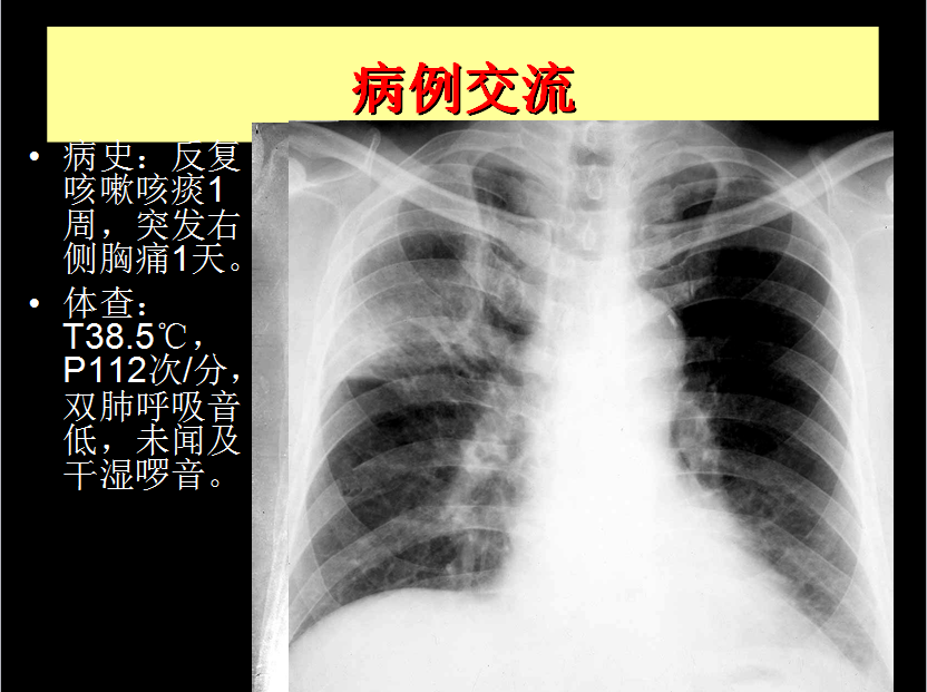 呼吸系统疾病X线诊断