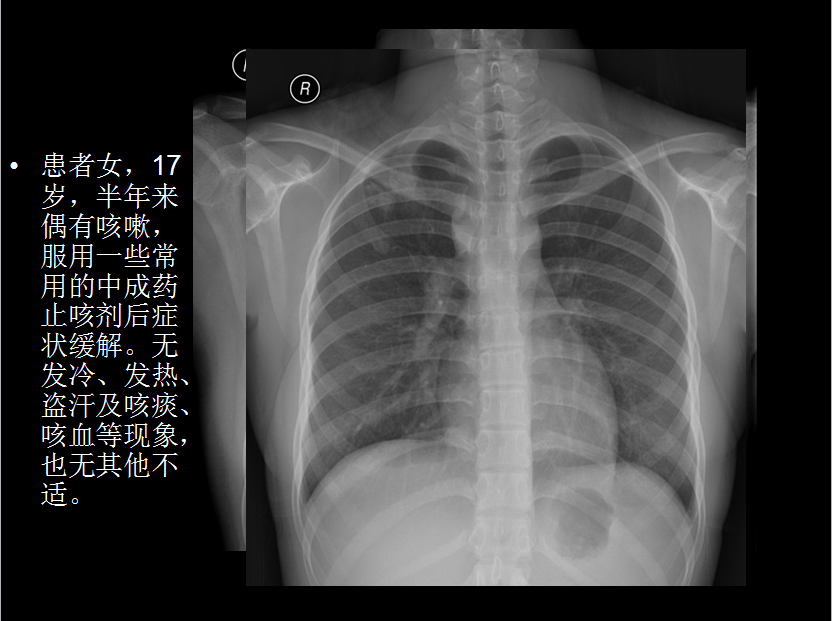 呼吸系统疾病X线诊断