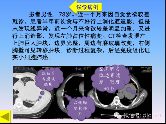 小细胞肺癌的临床CT病理特点及其征象分析