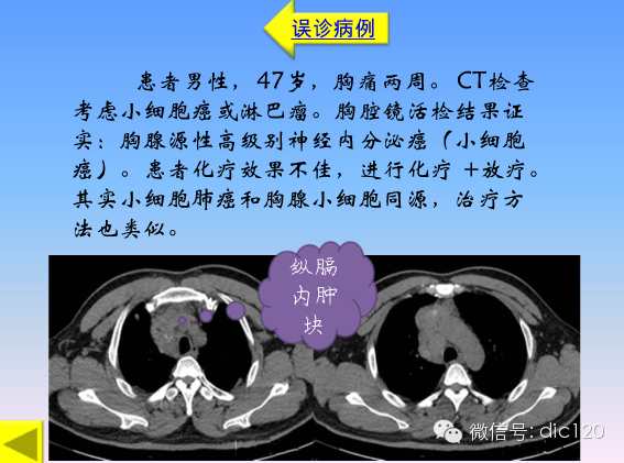小细胞肺癌的临床CT病理特点及其征象分析