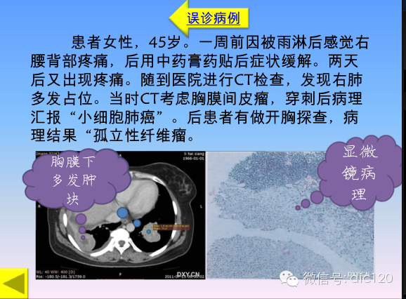 小细胞肺癌的临床CT病理特点及其征象分析