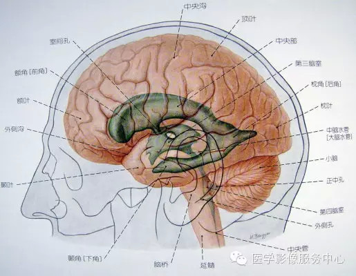 第五脑室、第六脑室以及中间帆腔(图文详解) 第五脑室、第六脑室以及中间帆腔(图文详解)