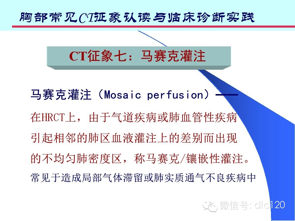 肺部CT十大征象诊断应用