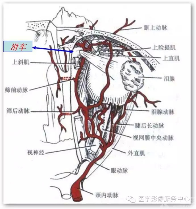眼部滑车钙化